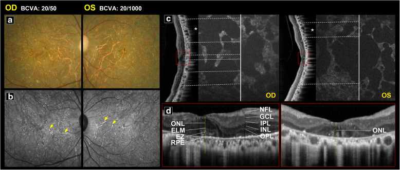 Fig. 4