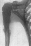 92