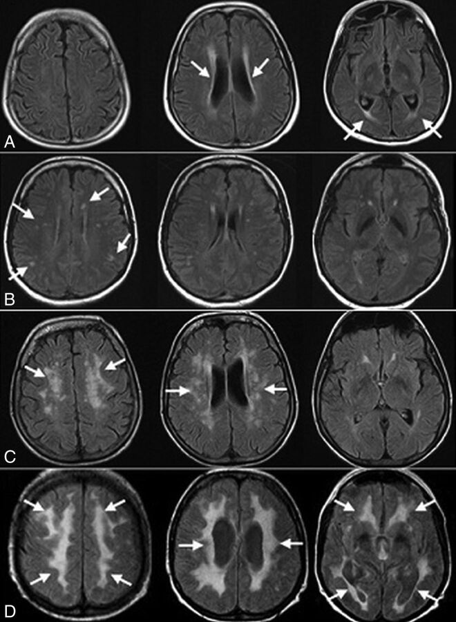 Fig 3.