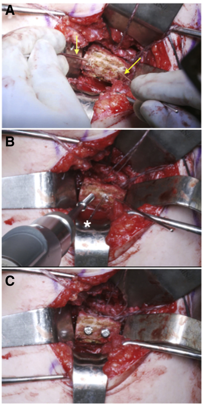 Fig 6