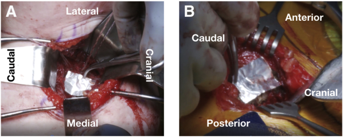 Fig 4