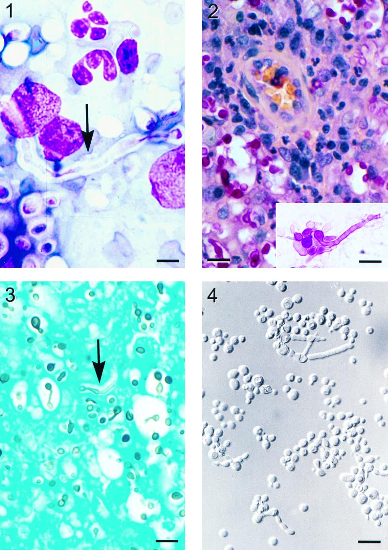 FIG. 1-4