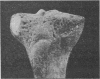 251