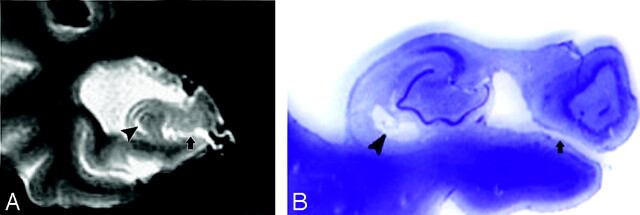 Fig 12.