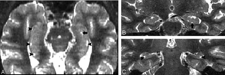 Fig 6.