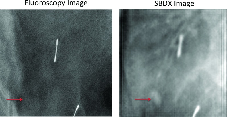 FIG. 10.