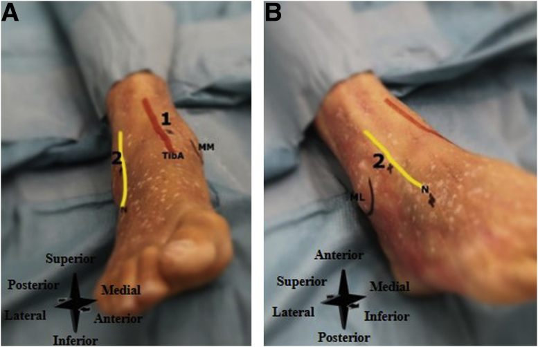 Fig 13