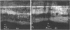 Fig. 11