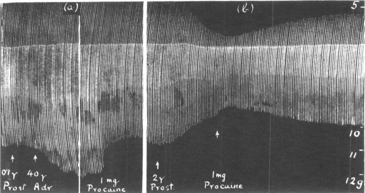 Fig. 14