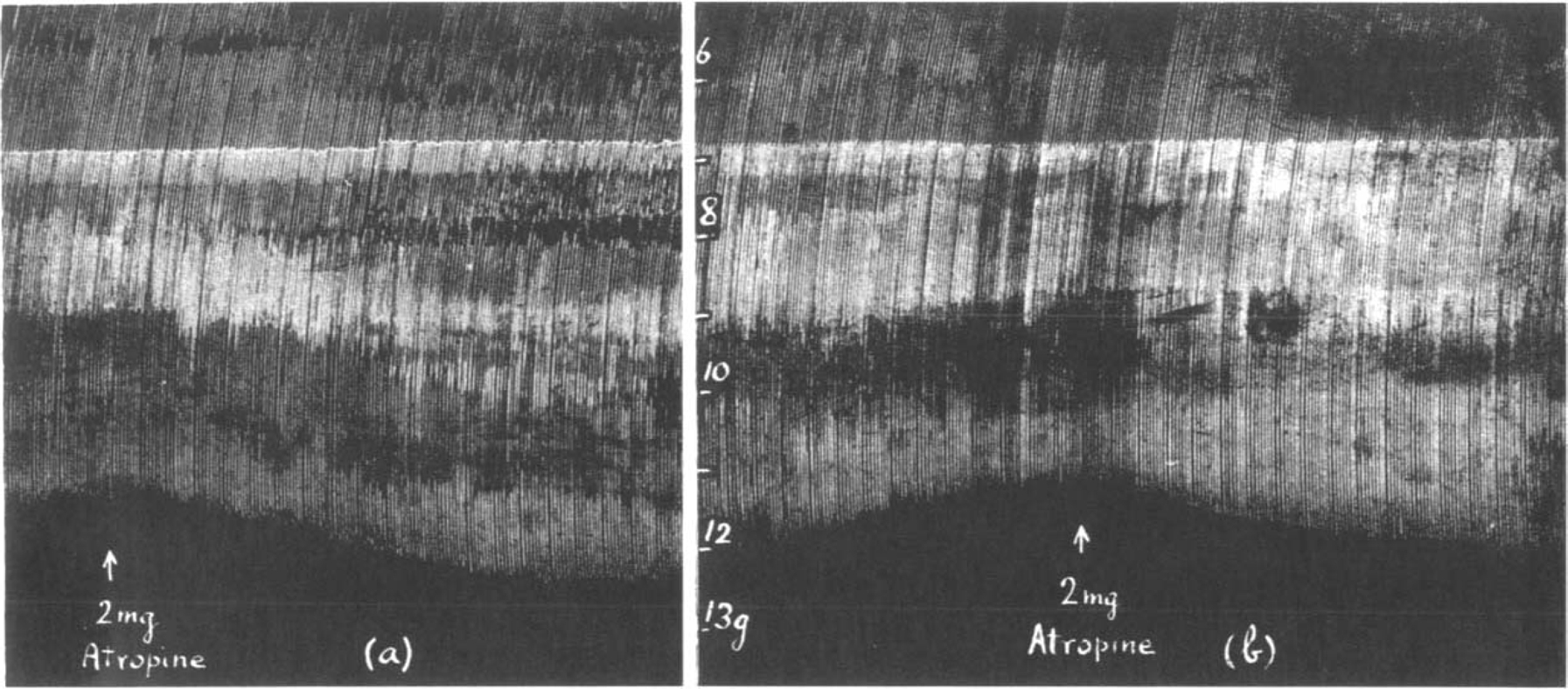 Fig. 11