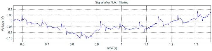 Figure 15