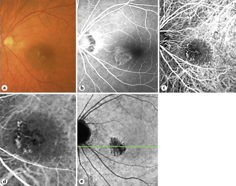 Fig. 1