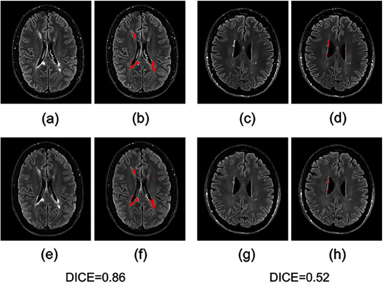 Fig. 5