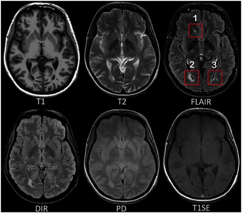 Fig. 1