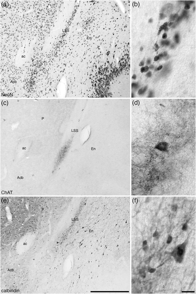 FIGURE 20