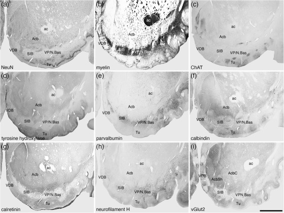 FIGURE 16