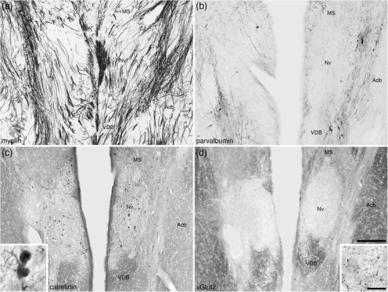 FIGURE 21