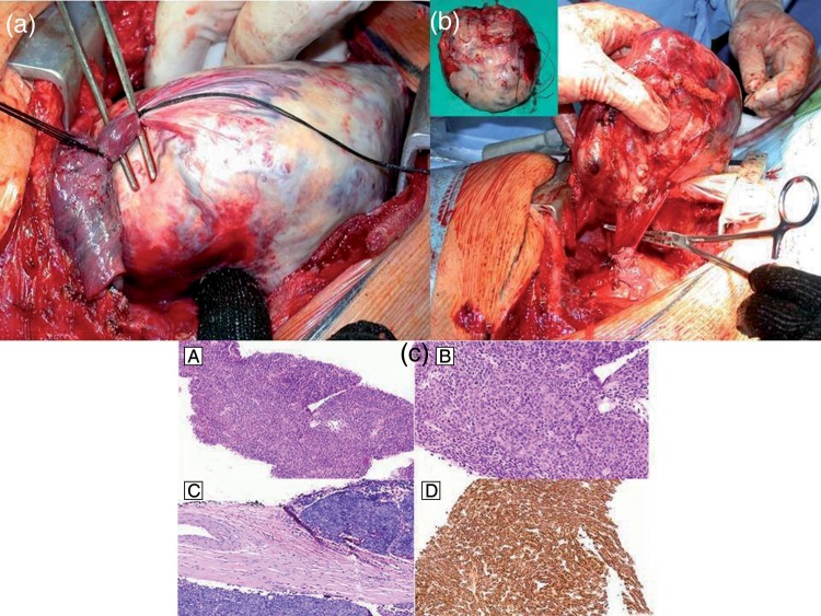 Figure 2: