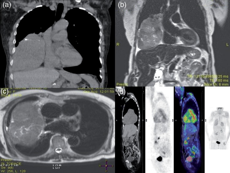 Figure 1: