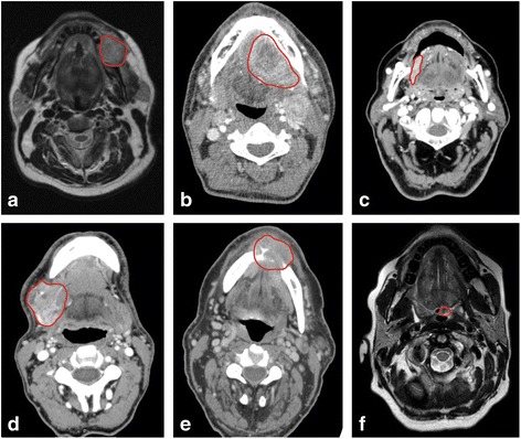 Fig. 1