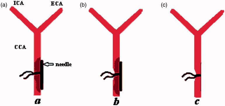 FIGURE 1