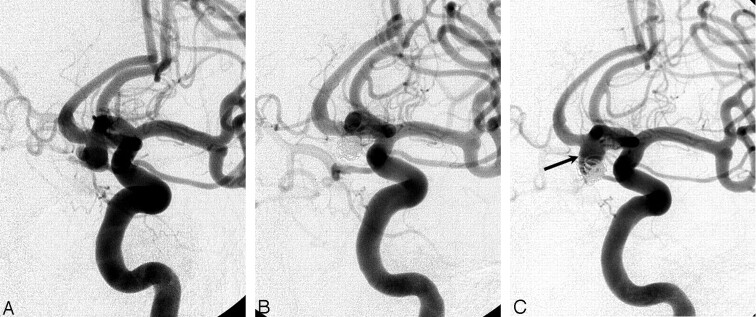 Fig 3.