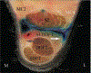 Figure 2—