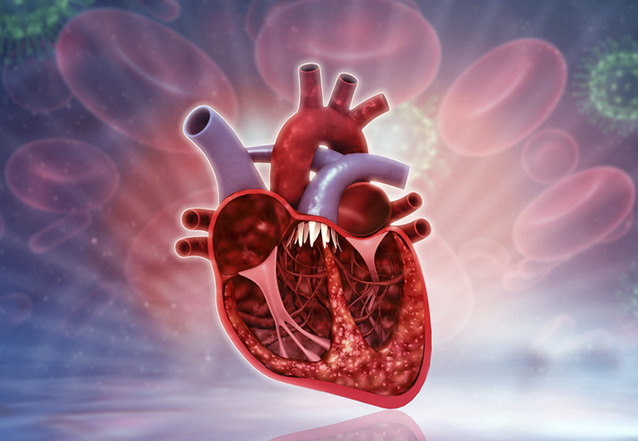 graphic file with name AnnalsATS.202008-1029EDf1.jpg