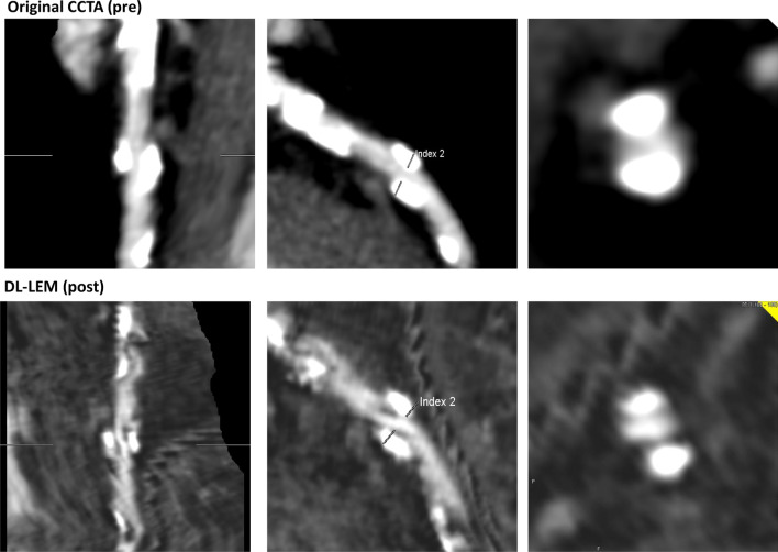 Fig. 5