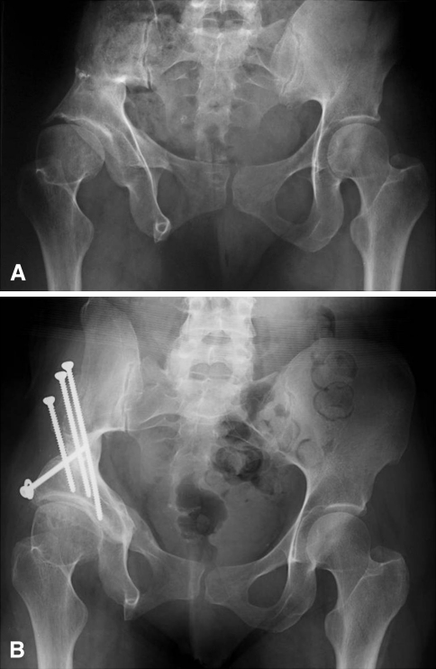 Fig. 2A–B