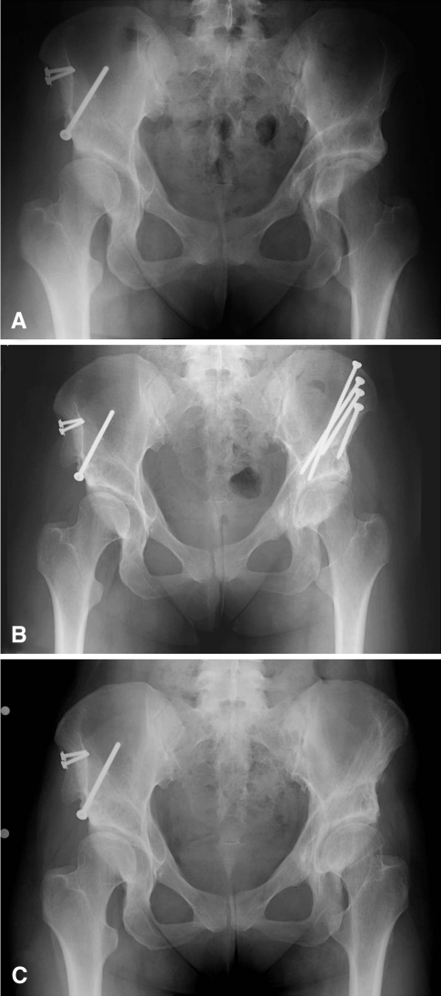 Fig. 1A–C