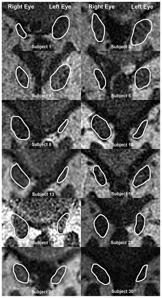 Fig. 3