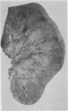91
