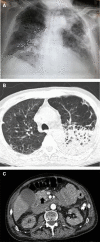 Fig. 1.
