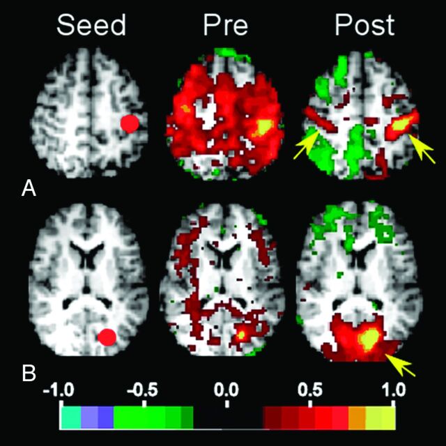 Fig 3.