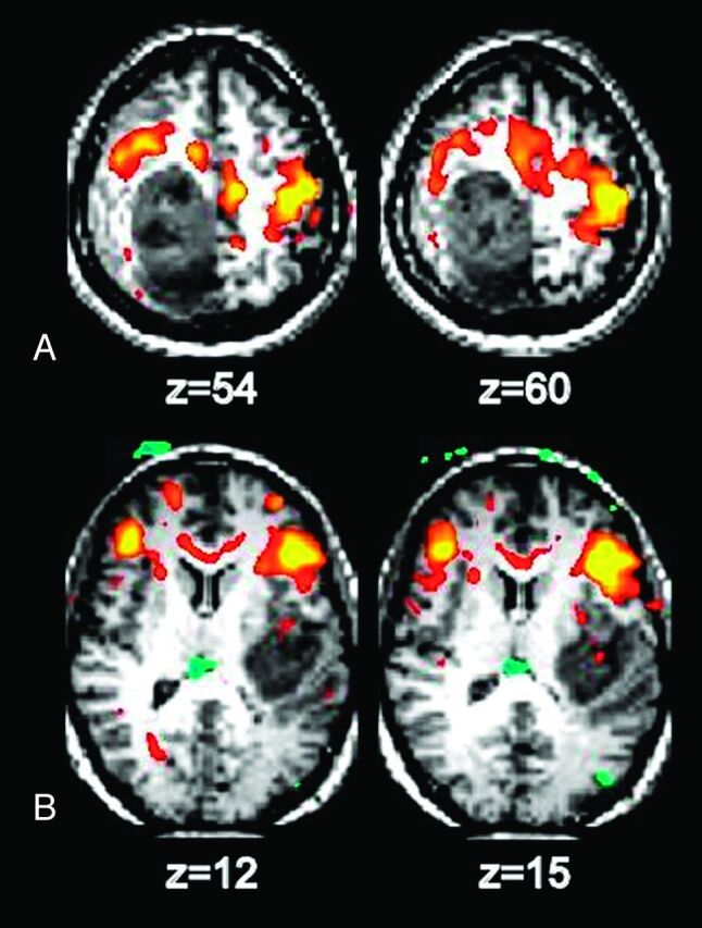 Fig 2.