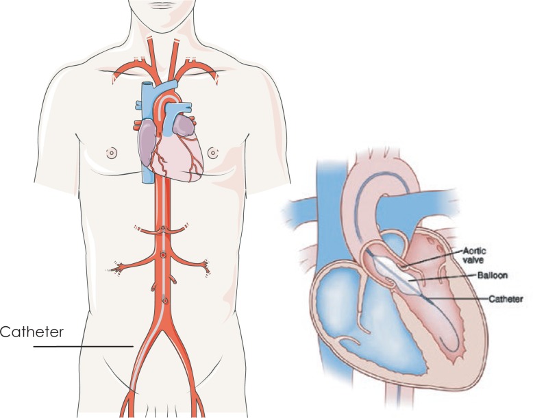 FIGURE 1.