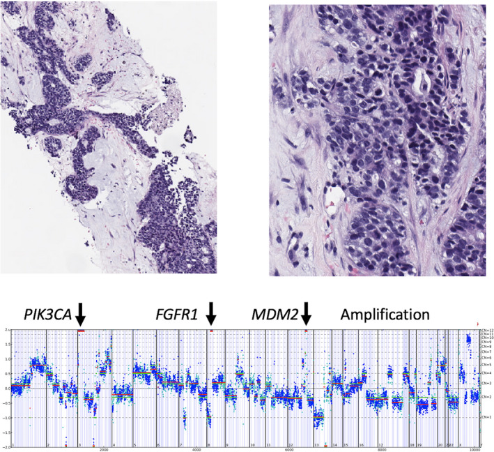 FIGURE 3