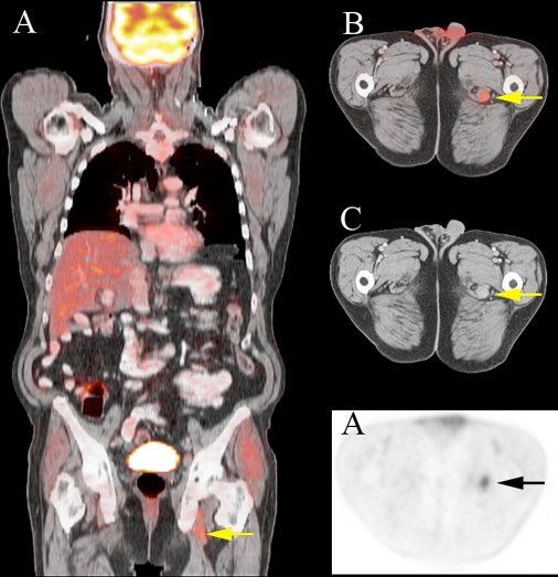 Fig. 2