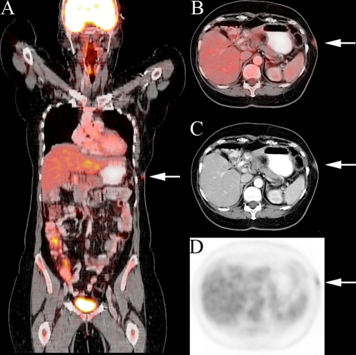 Fig. 1