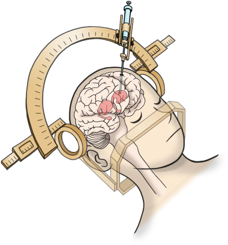 Fig. 2