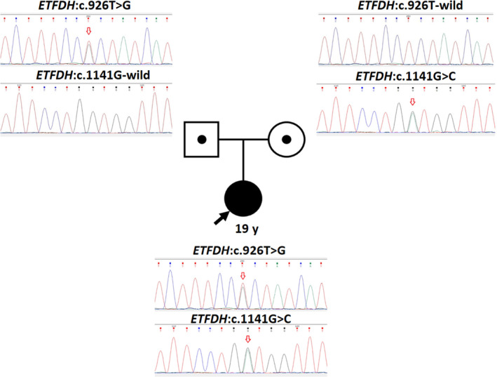 FIGURE 3