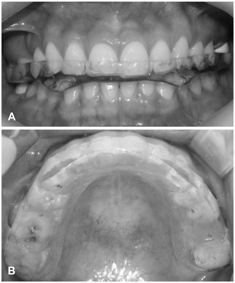 Fig. 5