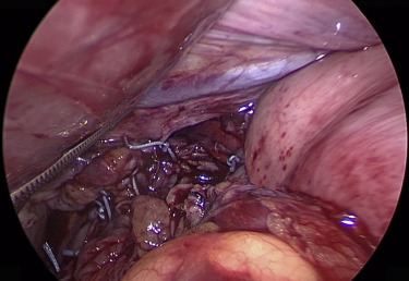 Figure 9