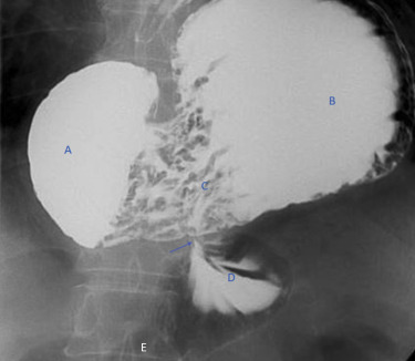 Figure 3