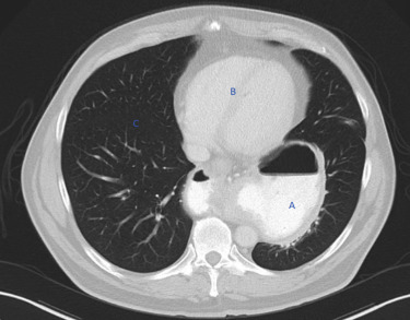 Figure 2