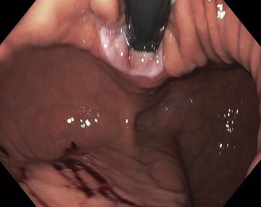 Figure 6