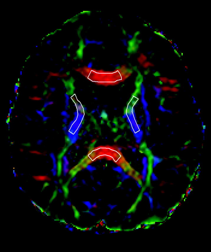 Fig 2.