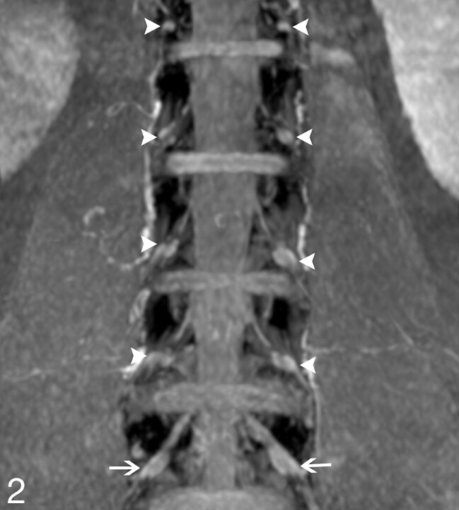 Fig 2.