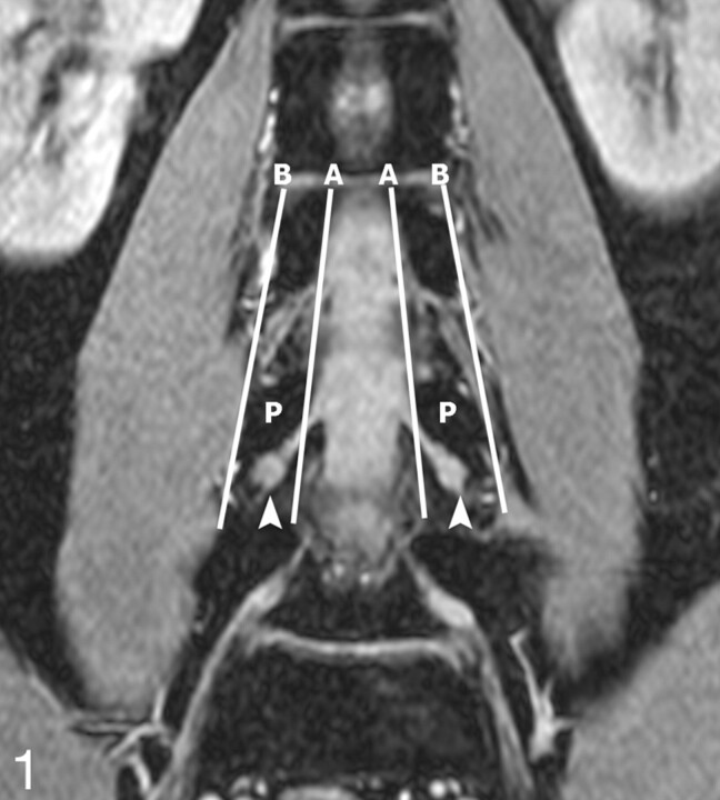 Fig 1.